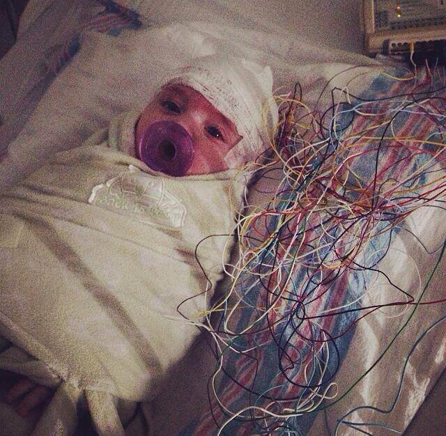 Infant EEG
