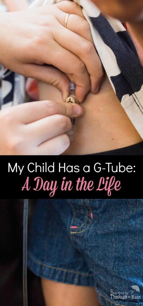 My Child has a G-Tube